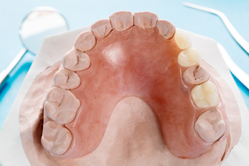 Close up, Artificial removable partial denture or temporary partial denture on blue ground.