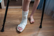 © Kiryakova Anna - Broken leg in plaster and crutches