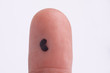 Pigmentation on fingertip skin close up