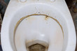 Unwashed public toilet. Dirty toilet bowl close-up.