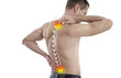 © dream@do - Man swith back and neck pain. Chiropractic concept.. Pain relief, Sport exercising injury