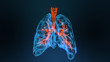 © appledesign - 3d rendered illustration of lung cancer 3D illustration
