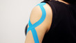 © yavdat - kinesiology taping treatment with blue tape on female patient injured arm. Sports injury kinesio treatment