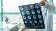 Leinwandbild Motiv Brain disease diagnosis with medical doctor seeing Magnetic Resonance Imaging (MRI) film diagnosing elderly ageing patient neurodegenerative illness problem for neurological medical treatment