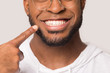 Leinwandbild Motiv Close up of biracial man show white healthy teeth