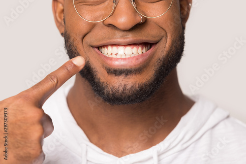 Fotografía Close up of biracial man show white healthy teeth