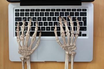 Wall Mural - Skeleton hands typing on laptop