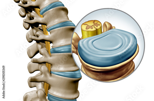 Cuadros en Lienzo Human Spine Disk Anatomy