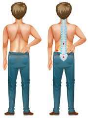 Poster - Man showing back pain on white background