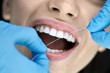Pretty woman's teeth cleaning in dental clinic