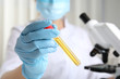© New Africa - Doctor holding test tube with urine sample for analysis in laboratory, closeup