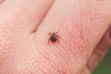  Dangerous Small Insect Mite Crawls On The Skin Of The Human Hand