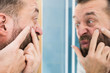 © Voyagerix - Man looking at pimples on his face