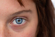 © Alessandro Grandini - Young girl with blue color eye iris close up