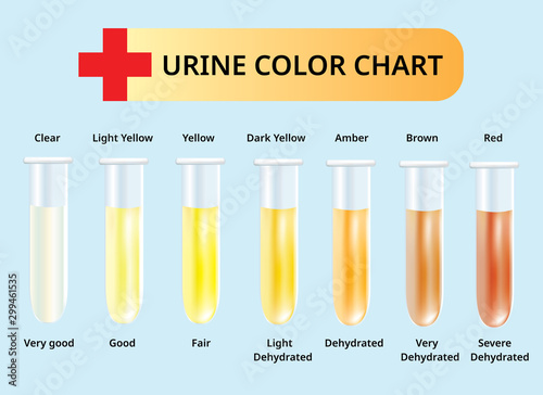 Cuadros en Lienzo Urine color chart, Urine in Test tubes, medical vector