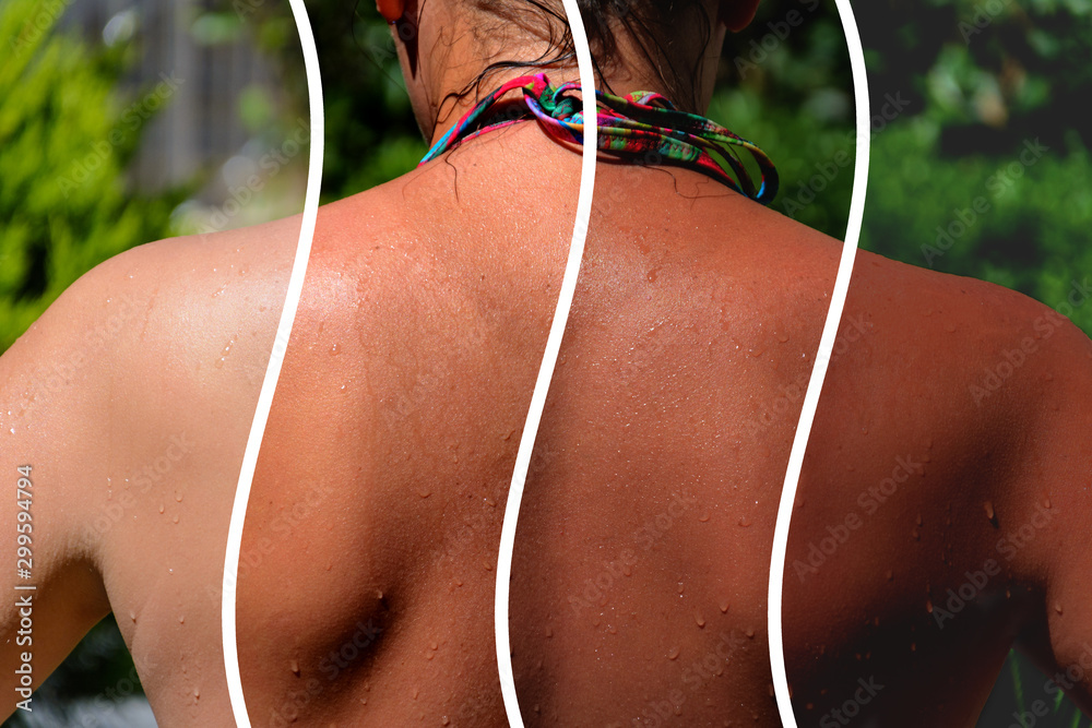 photo collage. back of a girl in a bikini with a demonstration of different shades of tan - obrazy, fototapety, plakaty 