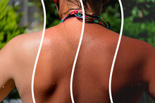 Photo Collage. Back Of A Girl In A Bikini With A Demonstration Of Different Shades Of Tan