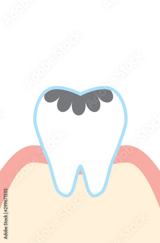 虫歯のかわいい歯のイラスト Cute Cartoon Decayed Tooth Illustration Buy This Stock Vector And Explore Similar Vectors At Adobe Stock Adobe Stock