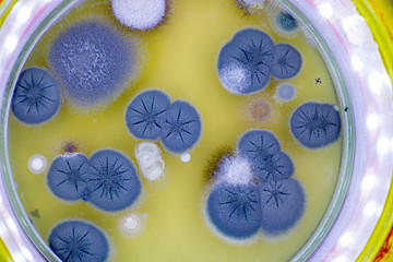 Poster - colony of skin fungi in a petri dish