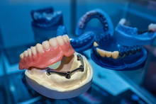 Dentistry. Models Of Removable Dentures. Prosthetics Of The Dental Cavity. Dentures On The Jaw. The Manufacture Of Dental Prostheses. Prosthetist. Dental Technician.