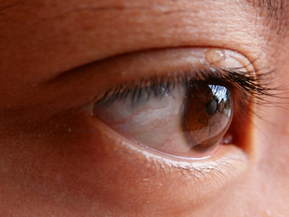 close up of human eye