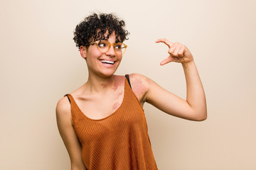 Wall Mural - Young african american woman with skin birth mark holding something little with forefingers, smiling and confident.