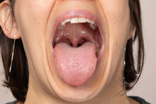 Tongue, Throat Examination Close Up
