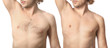 © Pixel-Shot - Young man before and after depilation on white background
