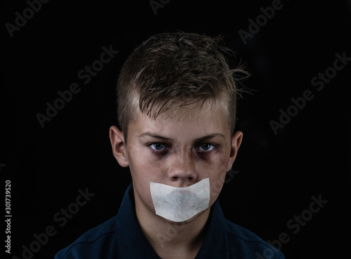 Cuadros en Lienzo Portrait of a scared beaten up boy victim of domestic violence and abuse with covered her mouth taped