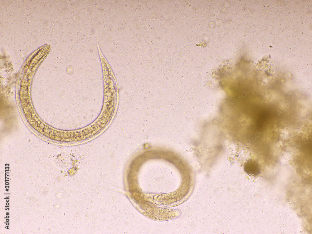 Strongyloides stercoralis or threadworm in human stool, analyze by ...