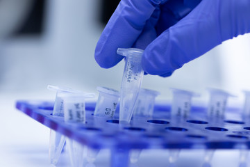 polymerase chain reaction (pcr) and agarose gel electrophoresis is a method of gel electrophoresis u