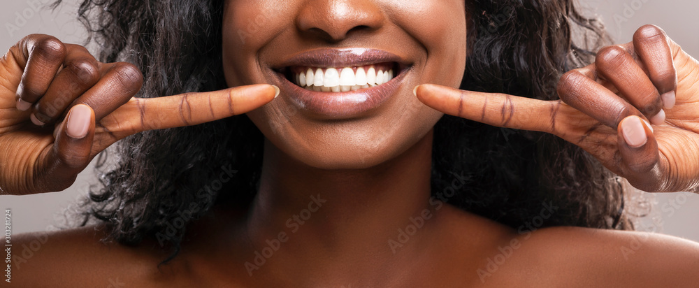 Unrecognizable black woman pointing at her healthy white teeth, closeup - obrazy, fototapety, plakaty 