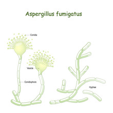Aspergillus Fumigatus Is  A Type Of Fungus Causes Aspergillosis