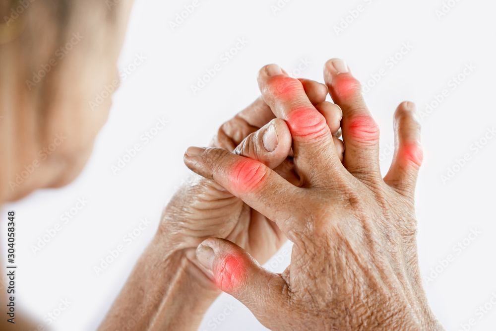 Asian woman hand suffering from joint pain with gout in finger - obrazy, fototapety, plakaty 