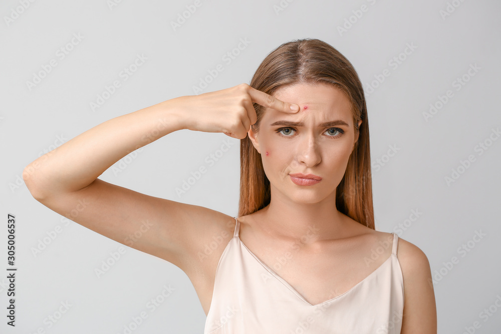 Portrait of young woman with acne problem on light background