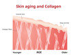 Skin aging, Collagen in young and old skin,