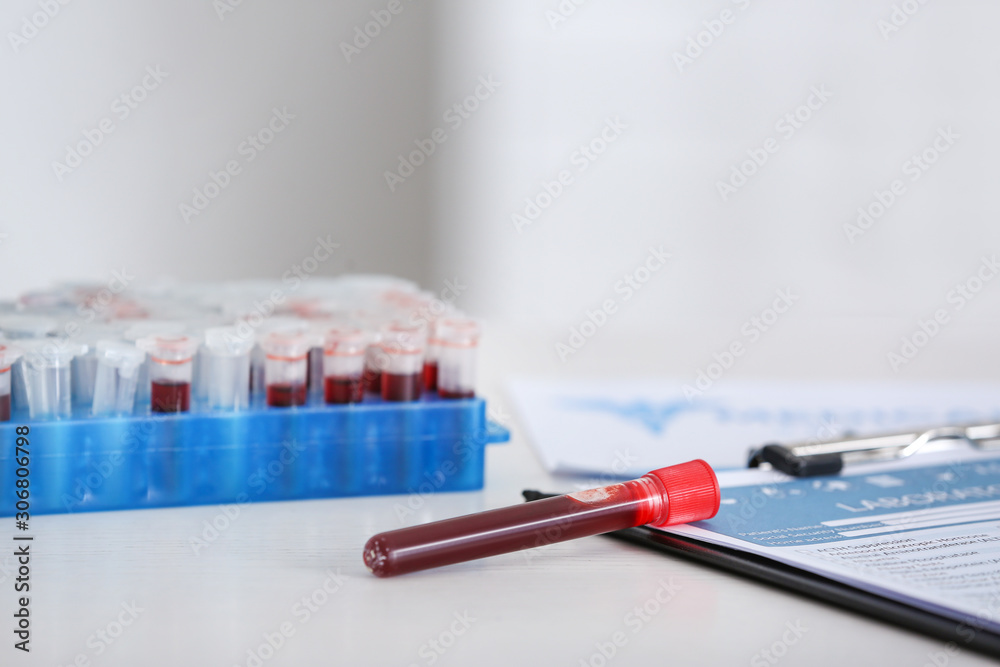 Test tube with blood sample on table in laboratory