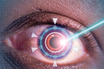 laser or lasik eye surgery concept, l laser beam shining into african america male dark brown eyes