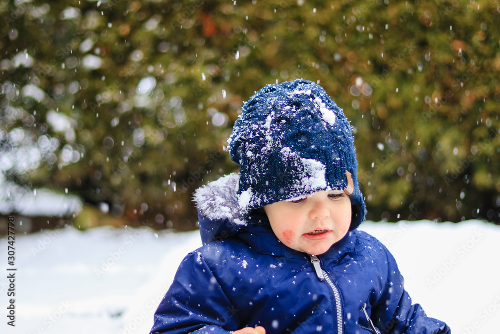 Portrait of little child with atopic eczema on cheeks at winter ...