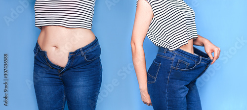 Cuadros en Lienzo Fat body and slim body collage, loosing weight concept.