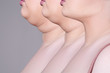 © staras - Double chin, skin rejuvenation on the neck, before after anti aging concept