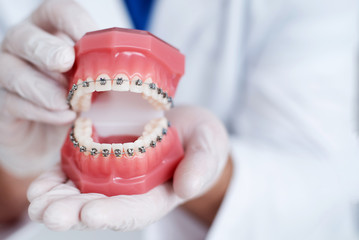 doctor orthodontist shows how the system of braces on teeth is arranged