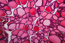 Thyroid Gland Dogs