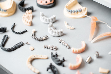 Various of artificial jaw models with dental implants and crowns on the white background. Concept of aesthetic dentistry and implantation technology