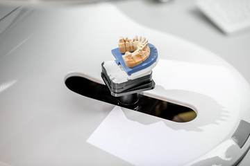 Aufkleber - Scanning jaw model on the 3rd scanner in the laboratory, for the manufacture of dentures or implants, close-up