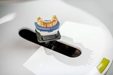 Aufkleber - Scanning jaw model on the 3rd scanner in the laboratory, for the manufacture of dentures or implants, close-up