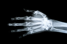 X-ray Picture Free Stock Photo - Public Domain Pictures