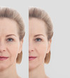 © missty - Beautiful middle-age woman face before after cosmetic procedures. Skin care for wrinkled face. Before-after anti-aging facelift treatment. Facial skincare and contouring.