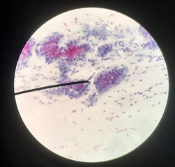 Wall Mural - Cells in reproductive female cytology and histology concept.