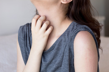 Young woman scratch the itch on her neck, Healthcare concept.